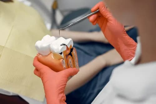 Root Canals Bristol PA Trusted Care for Lasting Tooth Pain Relief and Healthy Smiles