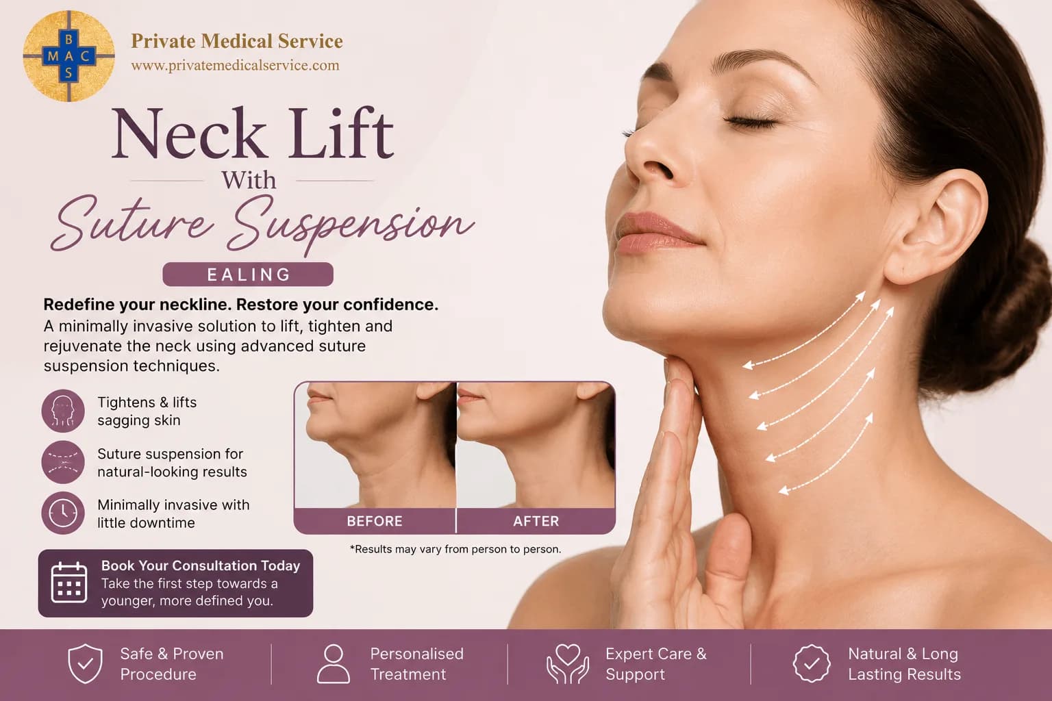 Professional Neck Lift With Suture Suspension Ealing for a Refined Appearance