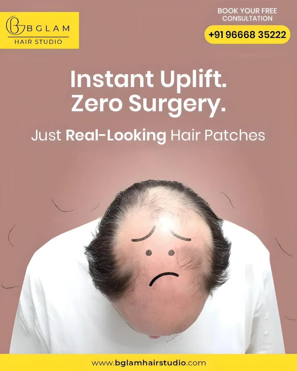 Best Hair Patch for Men | Hair patch services in Hyderabad