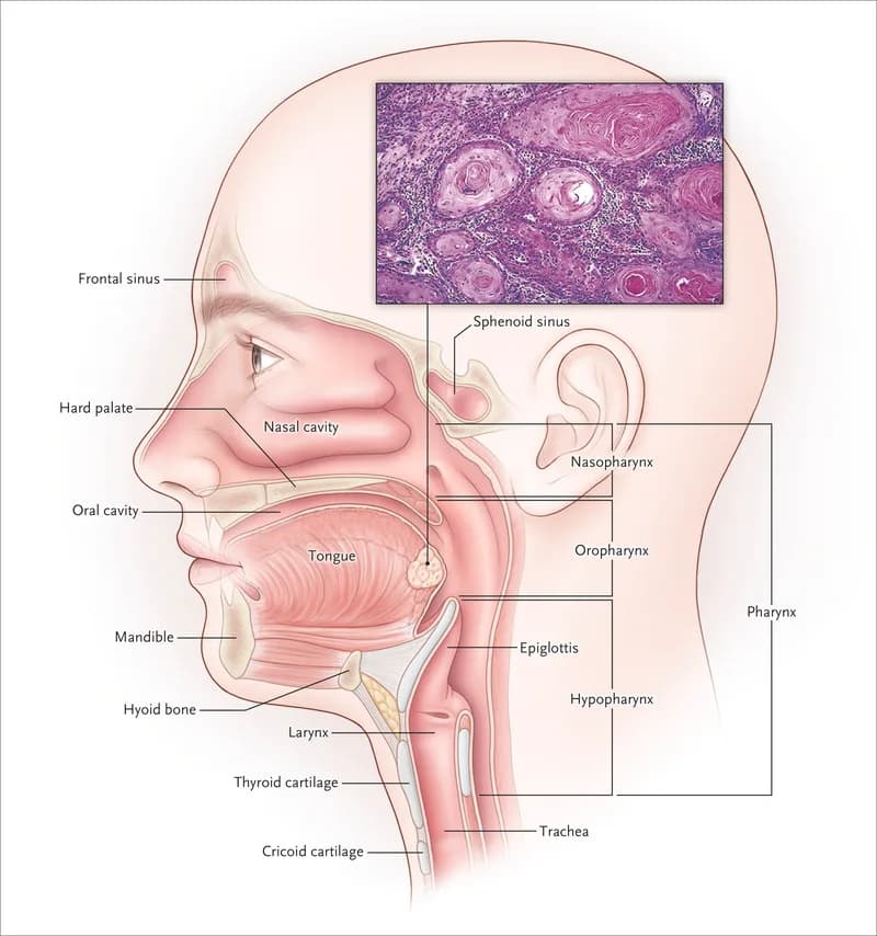 Best Head and Neck Cancer Treatment Expert in Noida | Cancer Consult