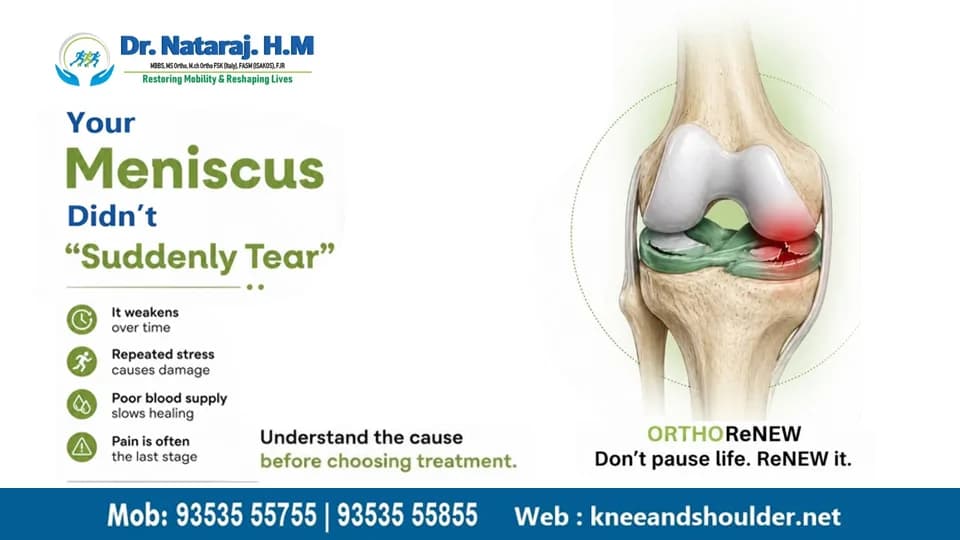 Best Orthopedic Doctor in Banngalore - Dr.Nataraj H M