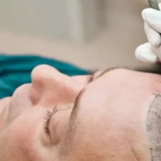 Regain Confidence with the Best Hair Transplant Specialist in Delhi NCR