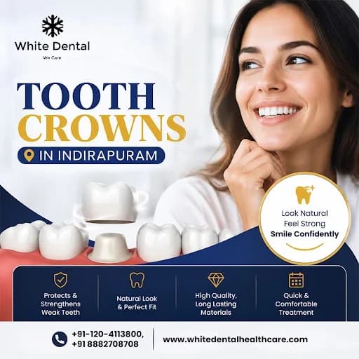 Tooth Crowns in Indirapuram for Restoring Damaged Teeth