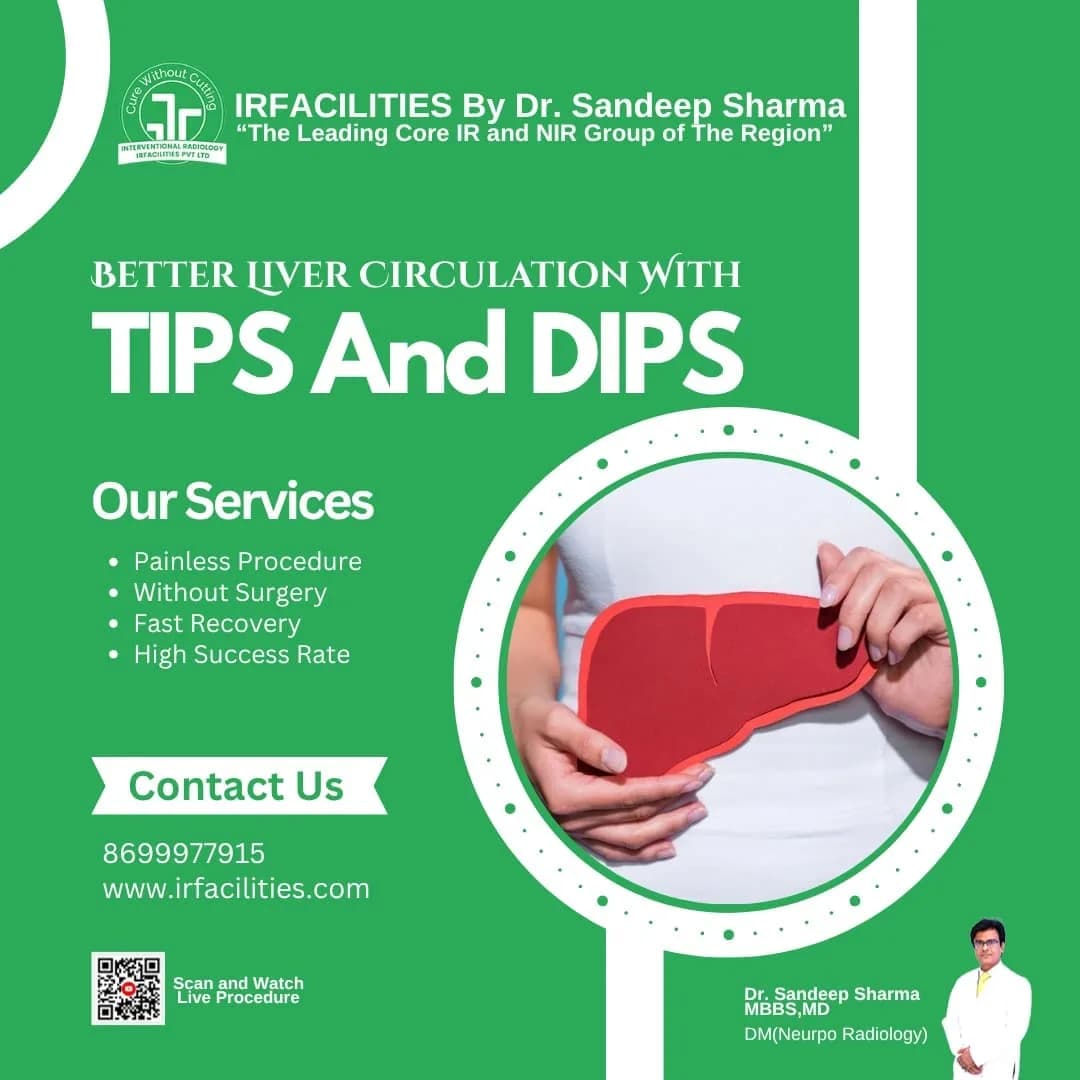 TIPS Shunt for Effective Management of Liver Disease Complications
