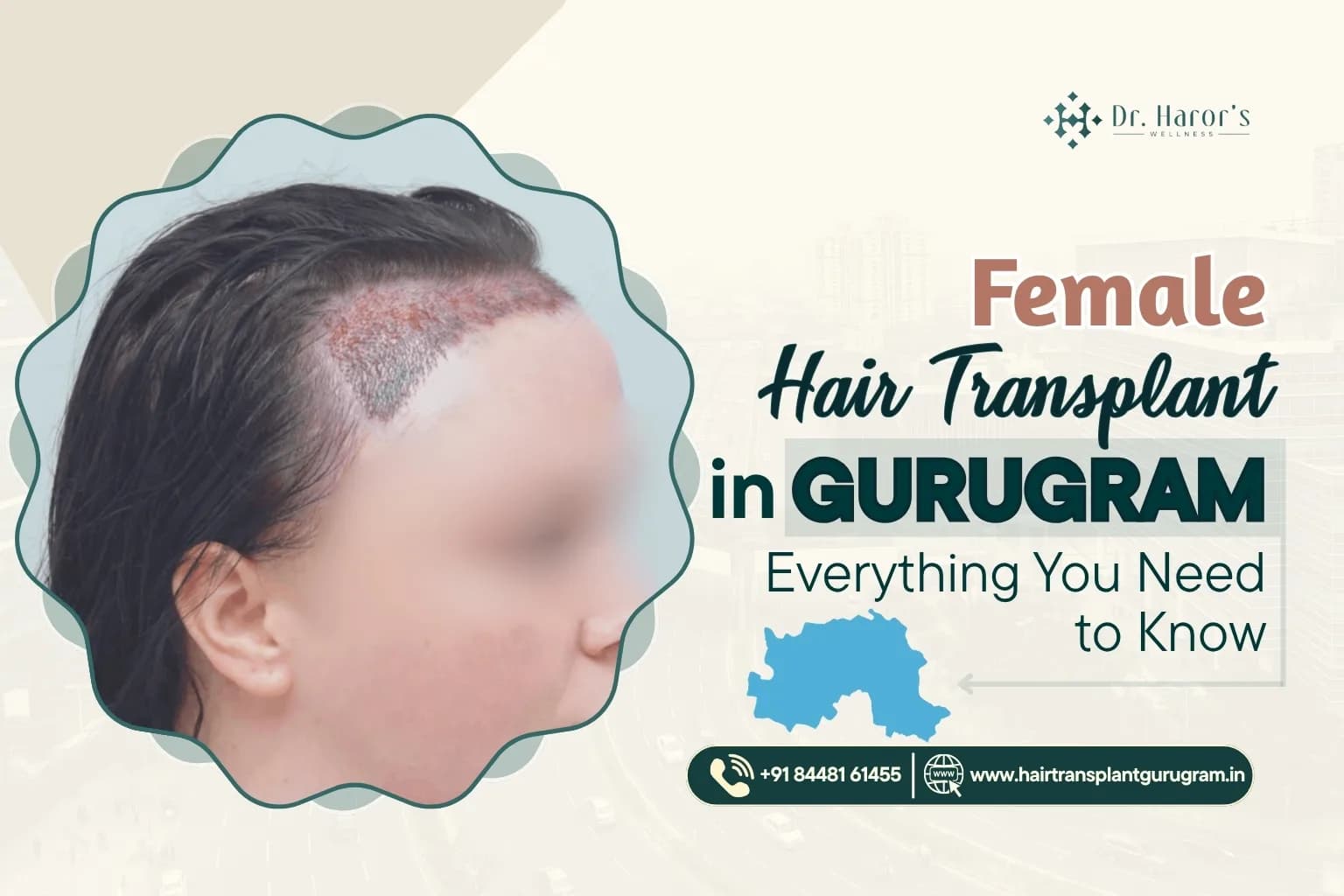 Female Hair Transplant in Gurugram: Everything You Need to Know