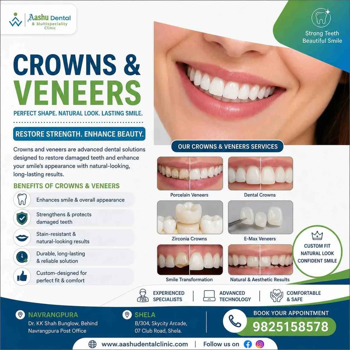 Top-Rated Crowns and Veneers Clinic Ahmedabad