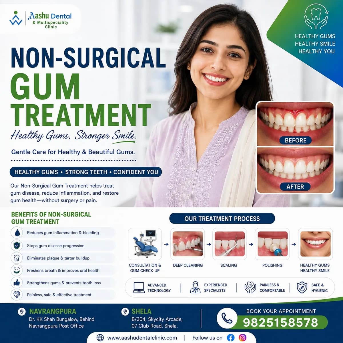 Non-Surgical Gum Treatment Ahmedabad - DR. Manish Shah