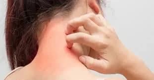 Allergy treatment near me