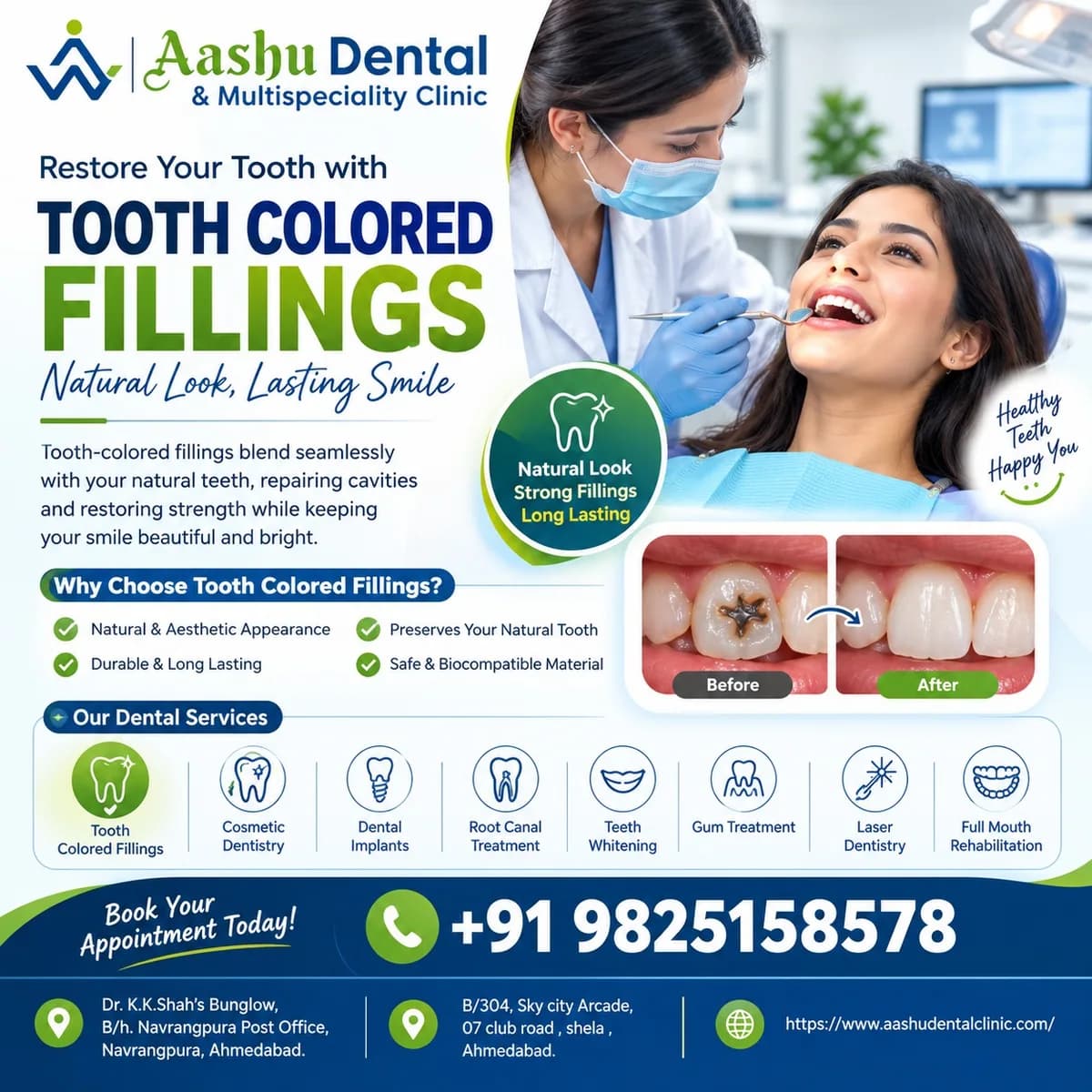 Restore Damaged Teeth with Tooth Colored Fillings in Ahmedabad