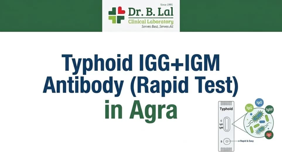 Typhoid IgG + IgM Test in Agra | Differentiate Active & Past Infection