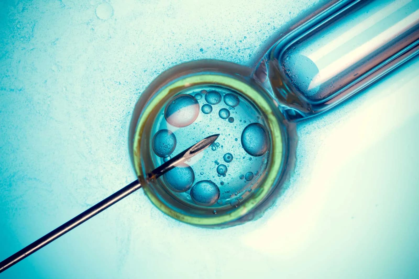 Assisted Embryo Hatching in Delhi by Fertylity IVF Specialists