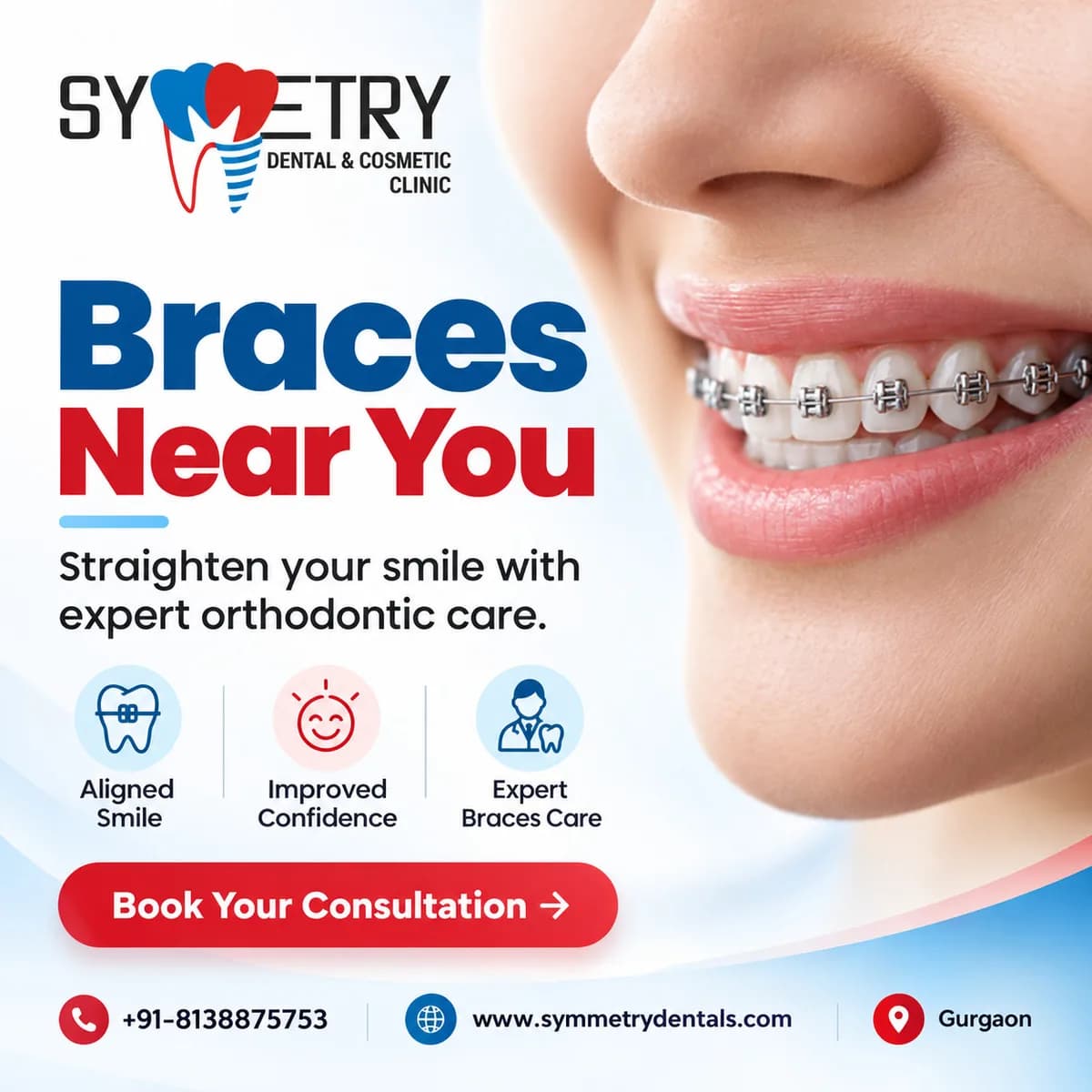  Braces near you for Straighter Teeth and Better Alignment