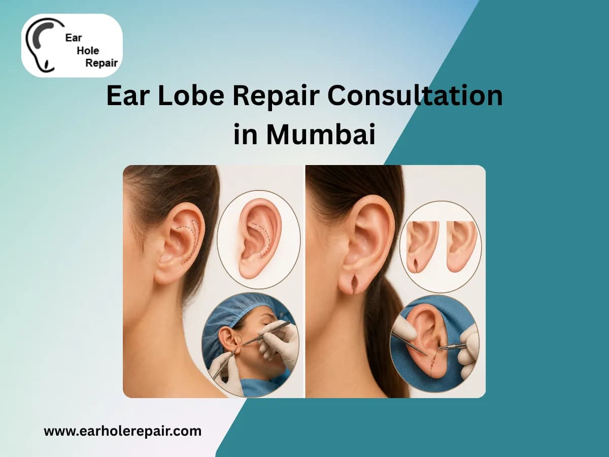 Ear Lobe Repair Consultation in Mumbai