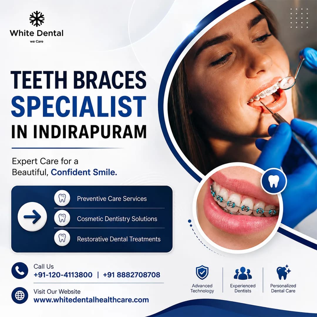 Teeth Braces Specialist in Indirapuram for Perfect Smiles