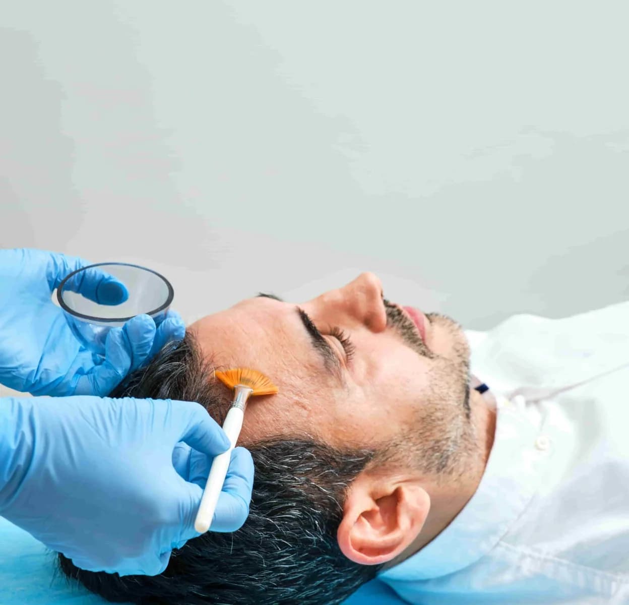Best Chemical Peel Treatment in Bengaluru | Best Chemical Peel Treatment in Bengaluru Near Me
