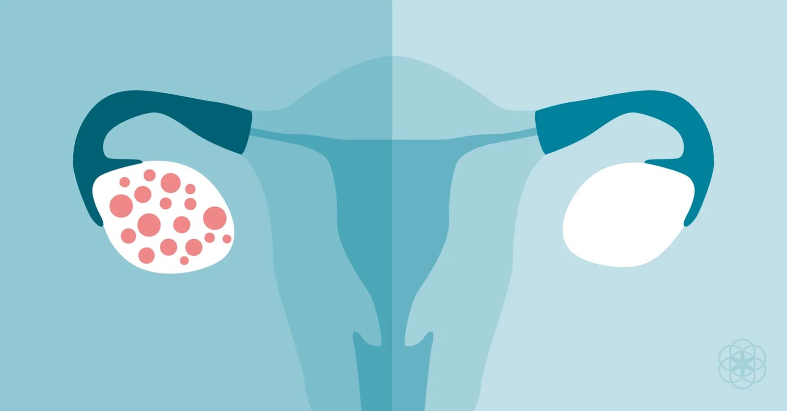 Best PCOD/PCOS Treatment in Delhi | Fertylity IVF Care
