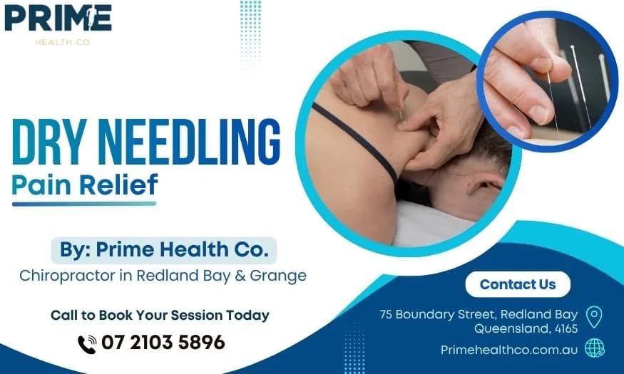 Trusted Dry Needling Specialists Brisbane | Prime Health Co.