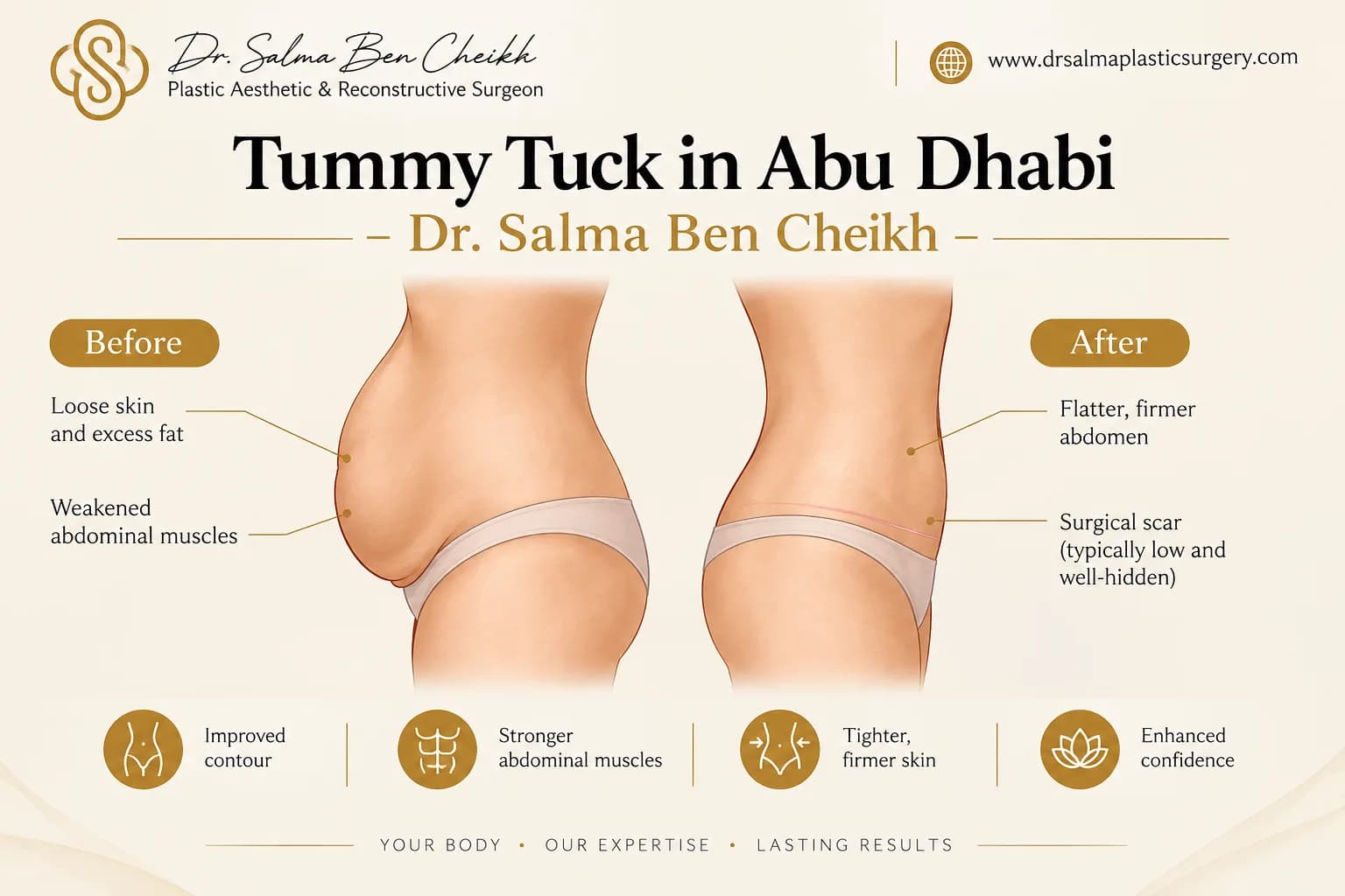 Tummy Tuck in Abu Dhabi - Dr. Salma Ben Cheikh