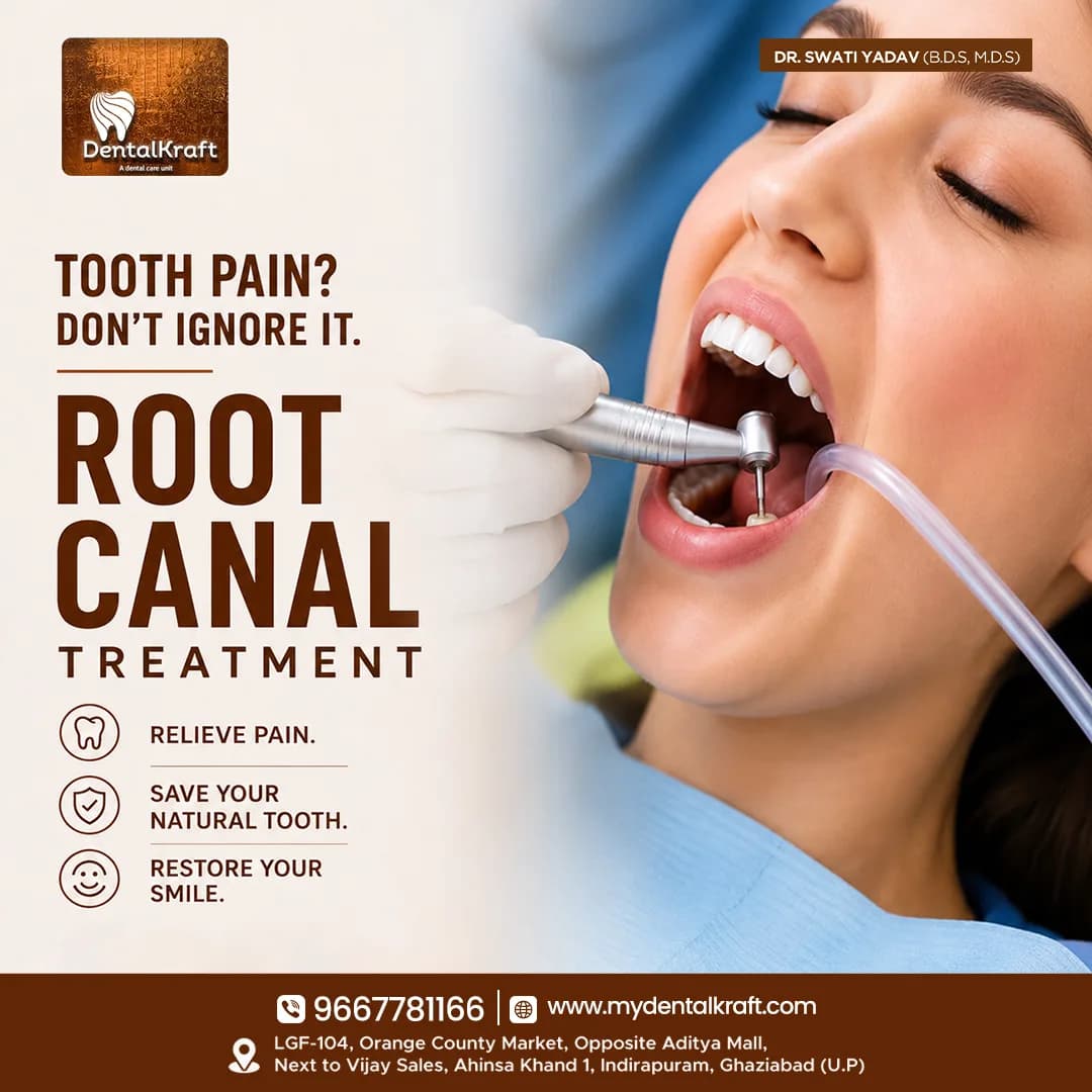 Best RCT Clinic in Indirapuram for Painless Treatment