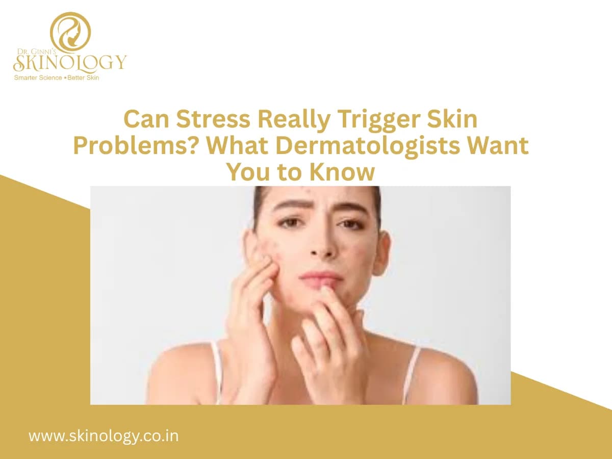Can Stress Really Trigger Skin Problems? What Dermatologists Want You to Know