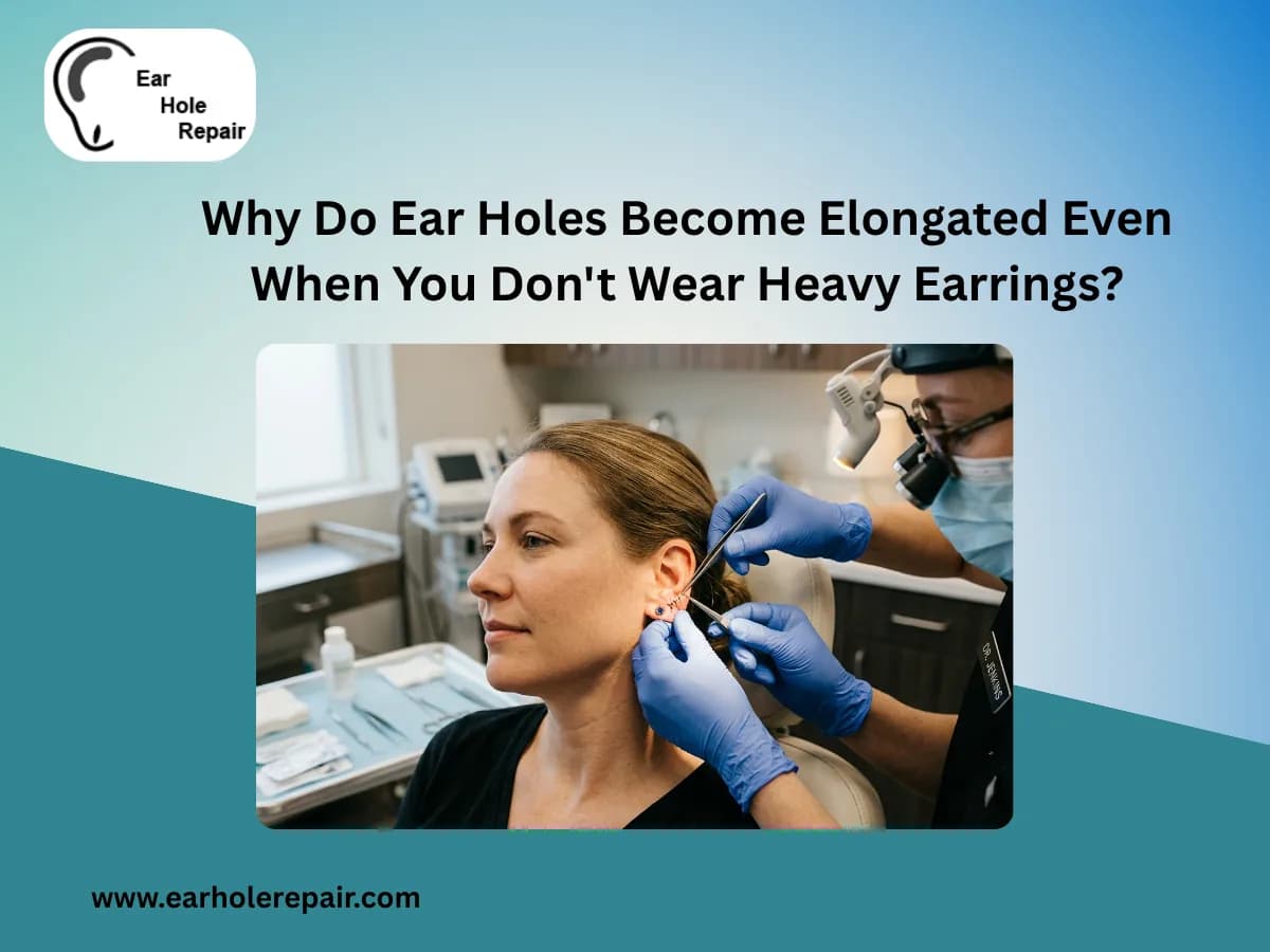 Why Do Ear Holes Become Elongated Even When You Don't Wear Heavy Earrings?