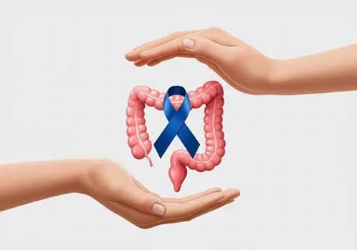 Colon Cancer Treatment in Noida | Dr. Manish Singhal Care