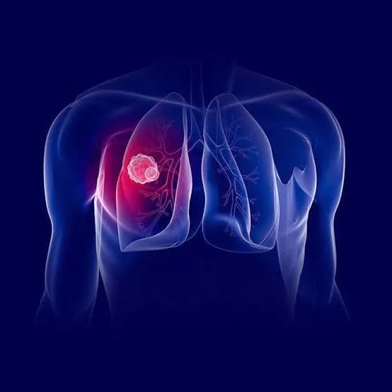Advanced Targeted Therapy Treatment in Noida | Dr. Manish Singhal