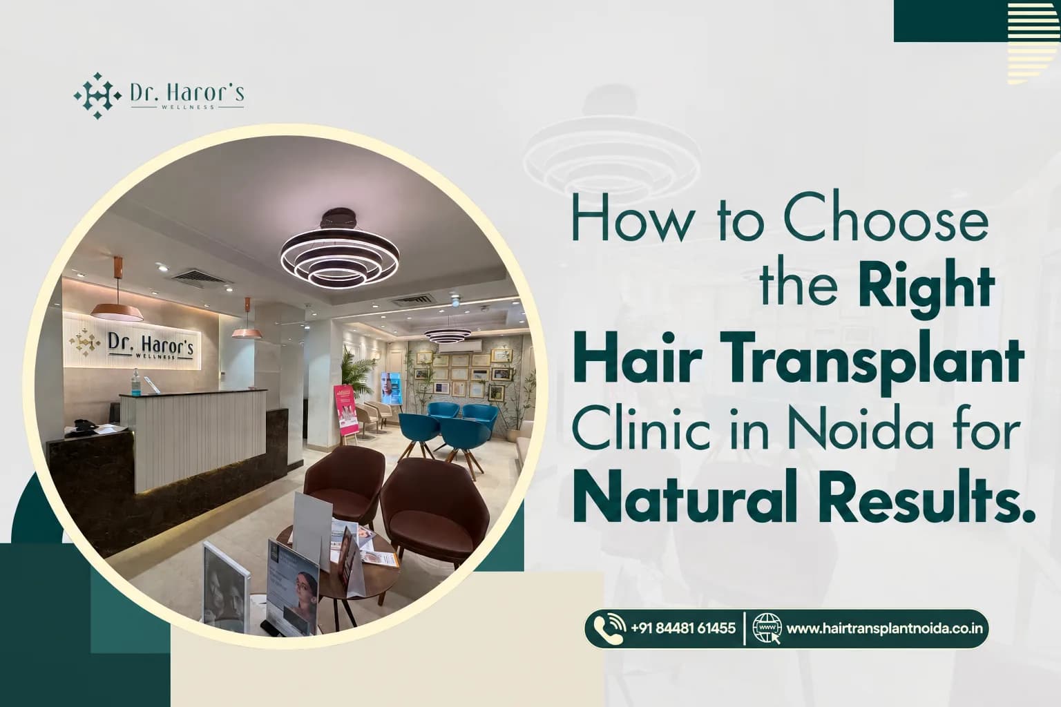 How to Choose the Right Hair Transplant Clinic in Noida for Natural Results