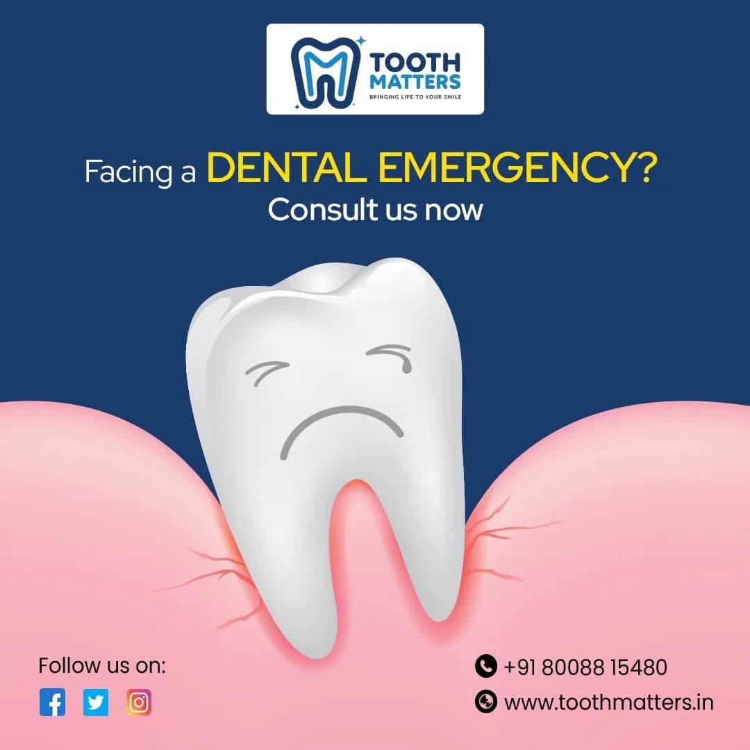 Expert Root Canal Treatment at Tooth Matters