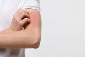 Update Treatment in Allergy