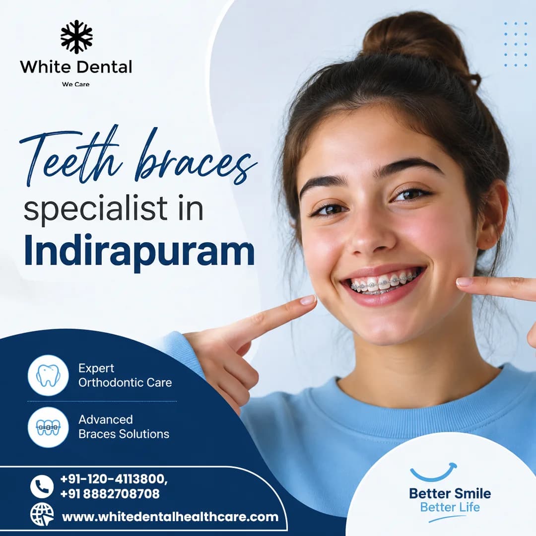 Teeth Braces Specialist in Indirapuram for Better Smile Alignment