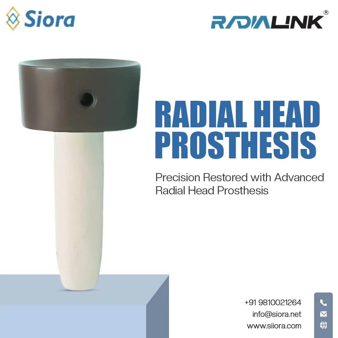 Precision Restored with Advanced Radial Head Prosthesis