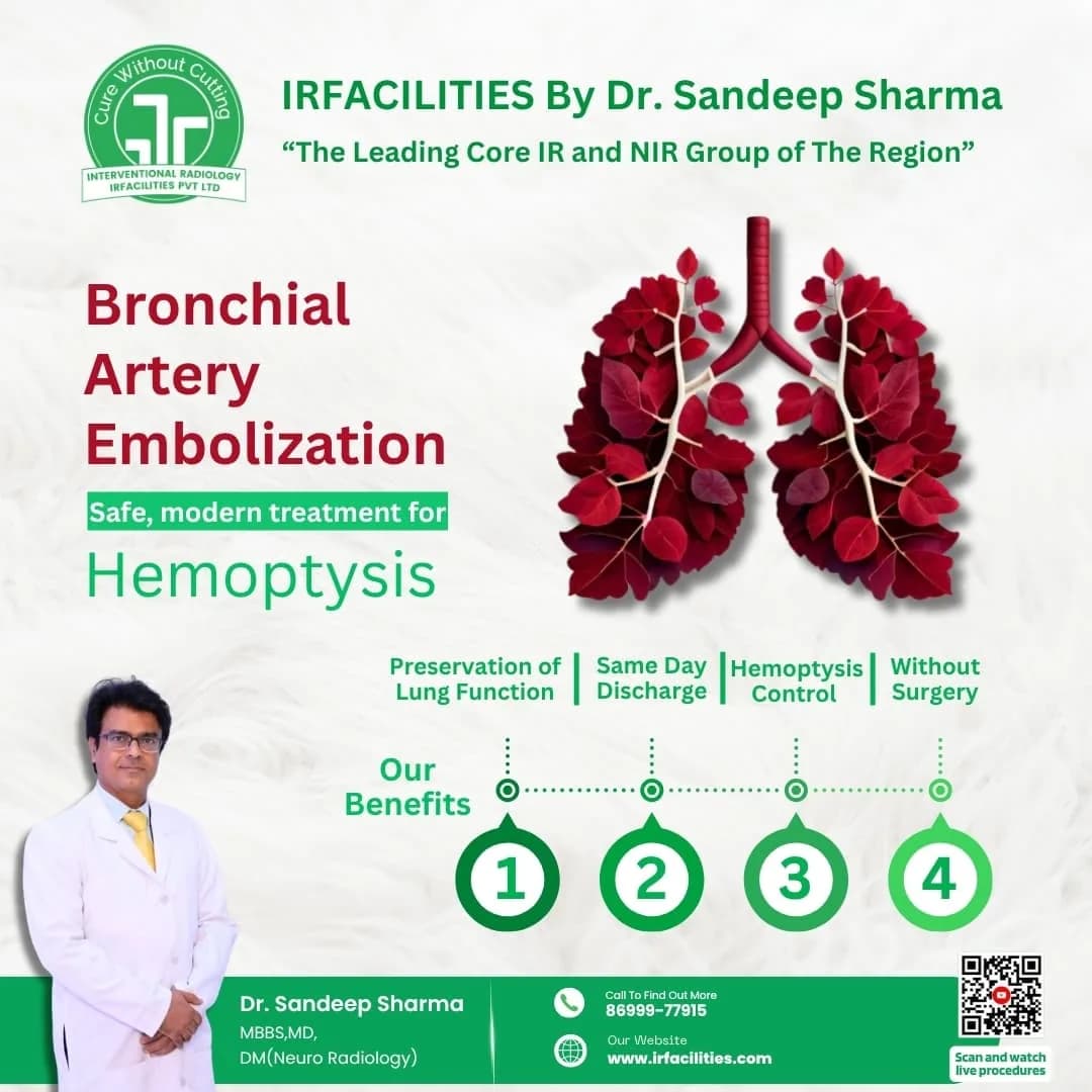 Bronchial Artery Embolization – A Proven Treatment for Severe/Low Lung Bleeds Without Surgery