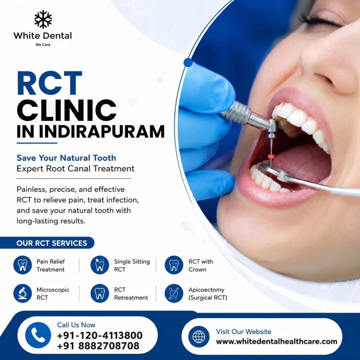RCT Clinic in Indirapuram for Root Canal Care