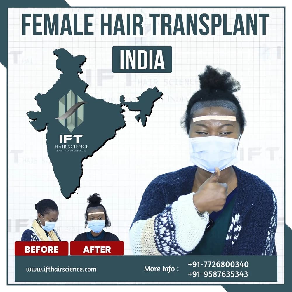 Hair transplant clinic in Gurgaon Delhi