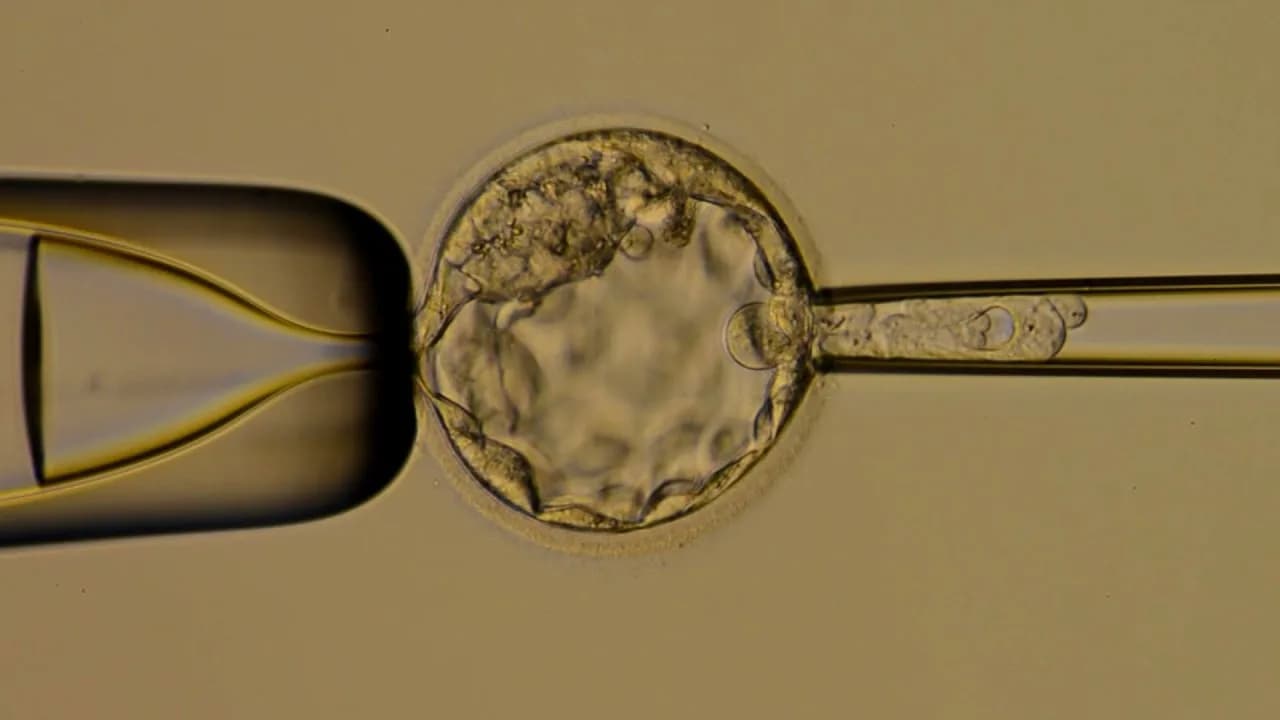 Blastocyst Transfer in Delhi with Personalized IVF Care | Fertylity IVF