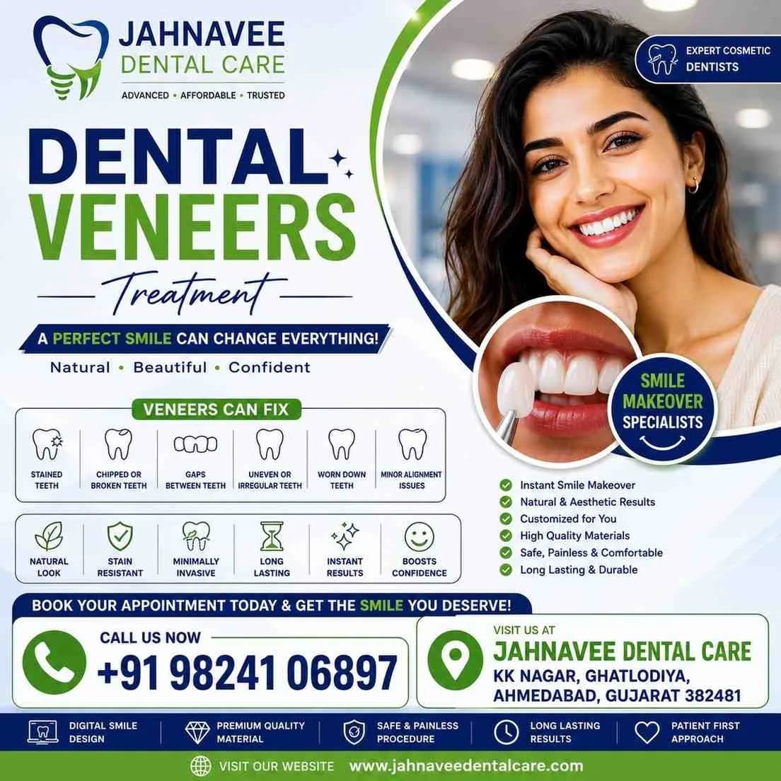 Dental Veneers Treatment in Ahmedabad - DR. Jahanvee