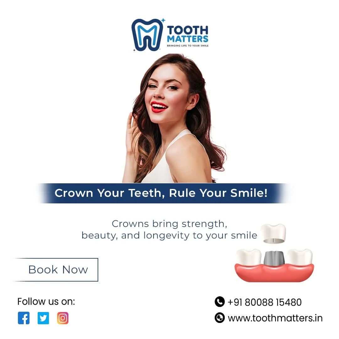 Zirconia Crown Solutions After Root Canal Treatment | Tooth Matters 