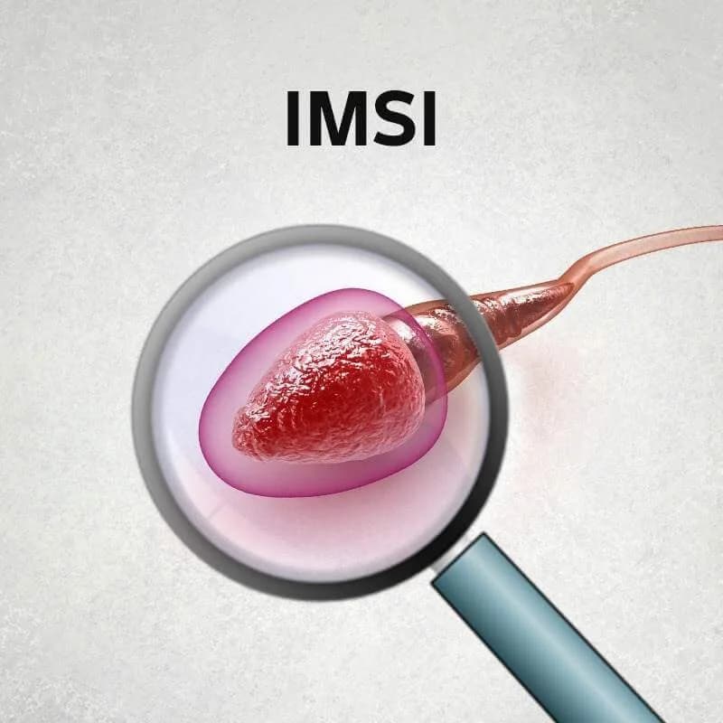Advanced IMSI Treatment in Delhi for Male Fertility Care