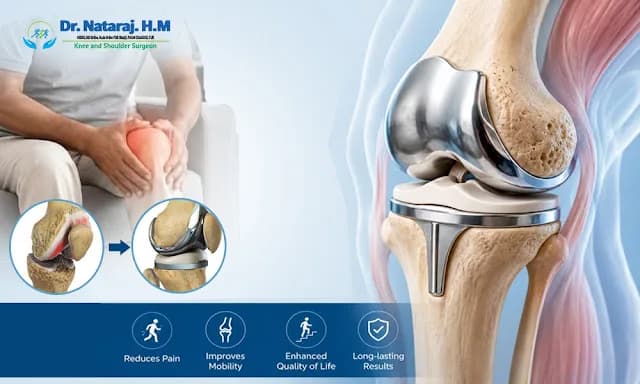 Best Knee Replacement Surgeon in Bangalore - Dr.Nataraj H M	