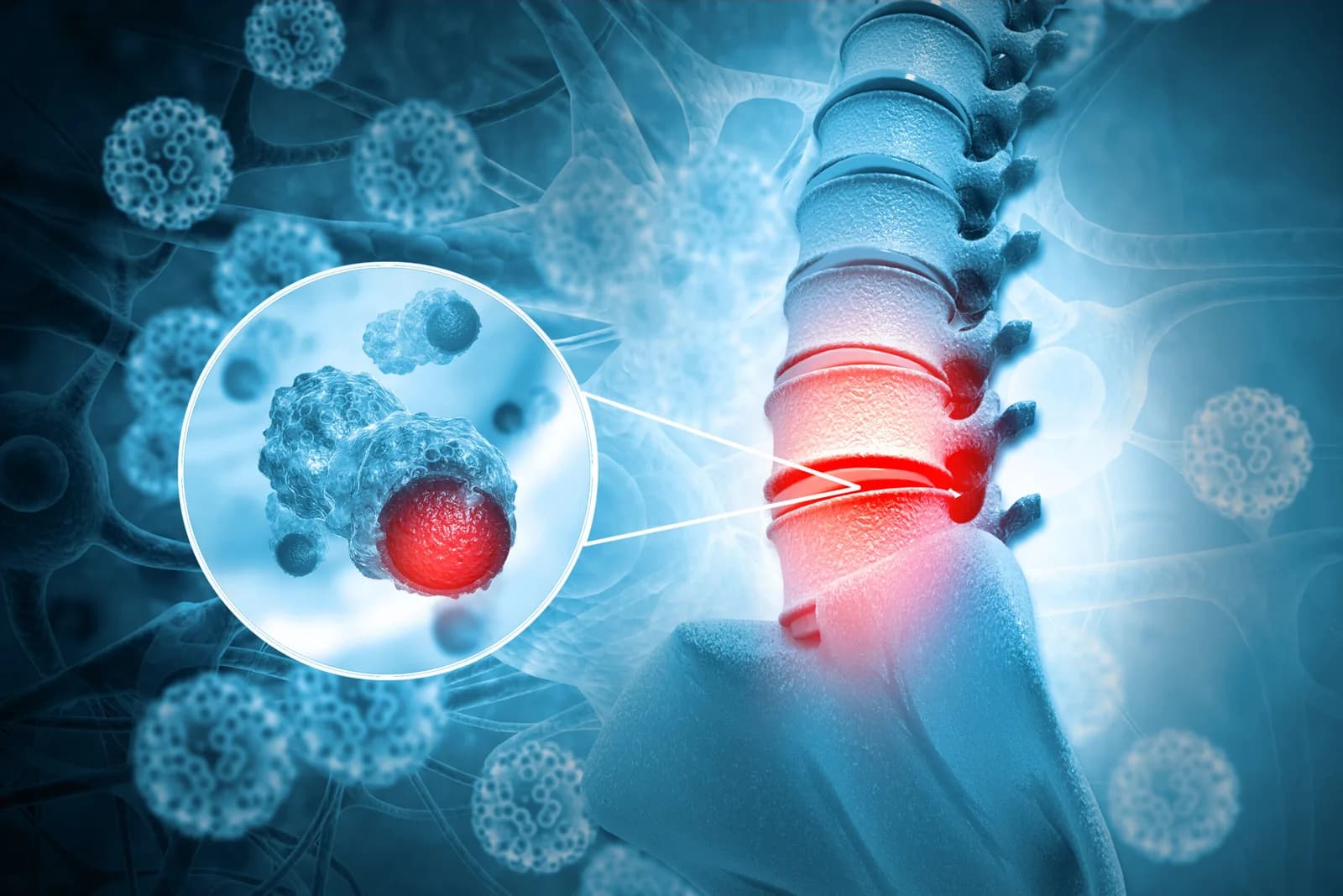 Leading Bone Cancer Specialist in Noida | Dr. Manish Singhal