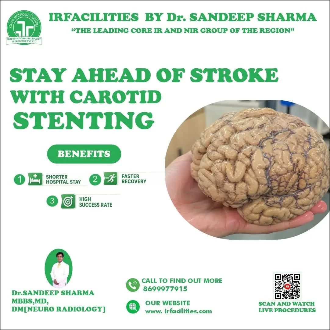 Safe Carotid Angioplasty With Stent Treatment in India