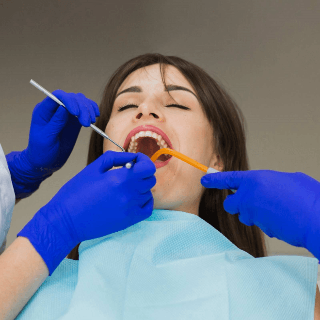Long-Lasting Tooth-Colored Fillings Available in Ahmedabad