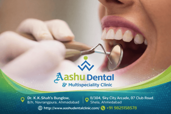 Crowns and Veneers Treatment in Gujarat – Dr. Manish Shah
