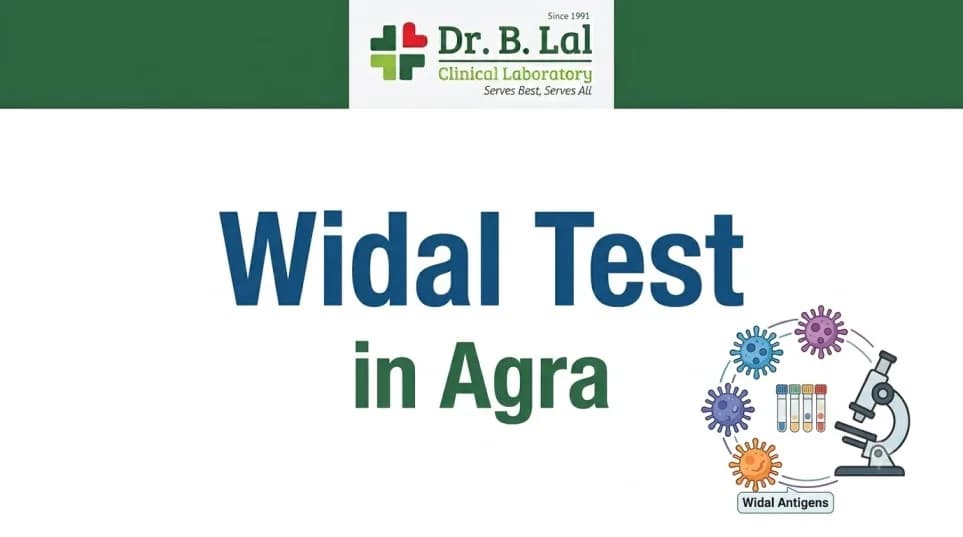 Widal Test for Children & Adults in Agra | Dr. B. Lal Lab