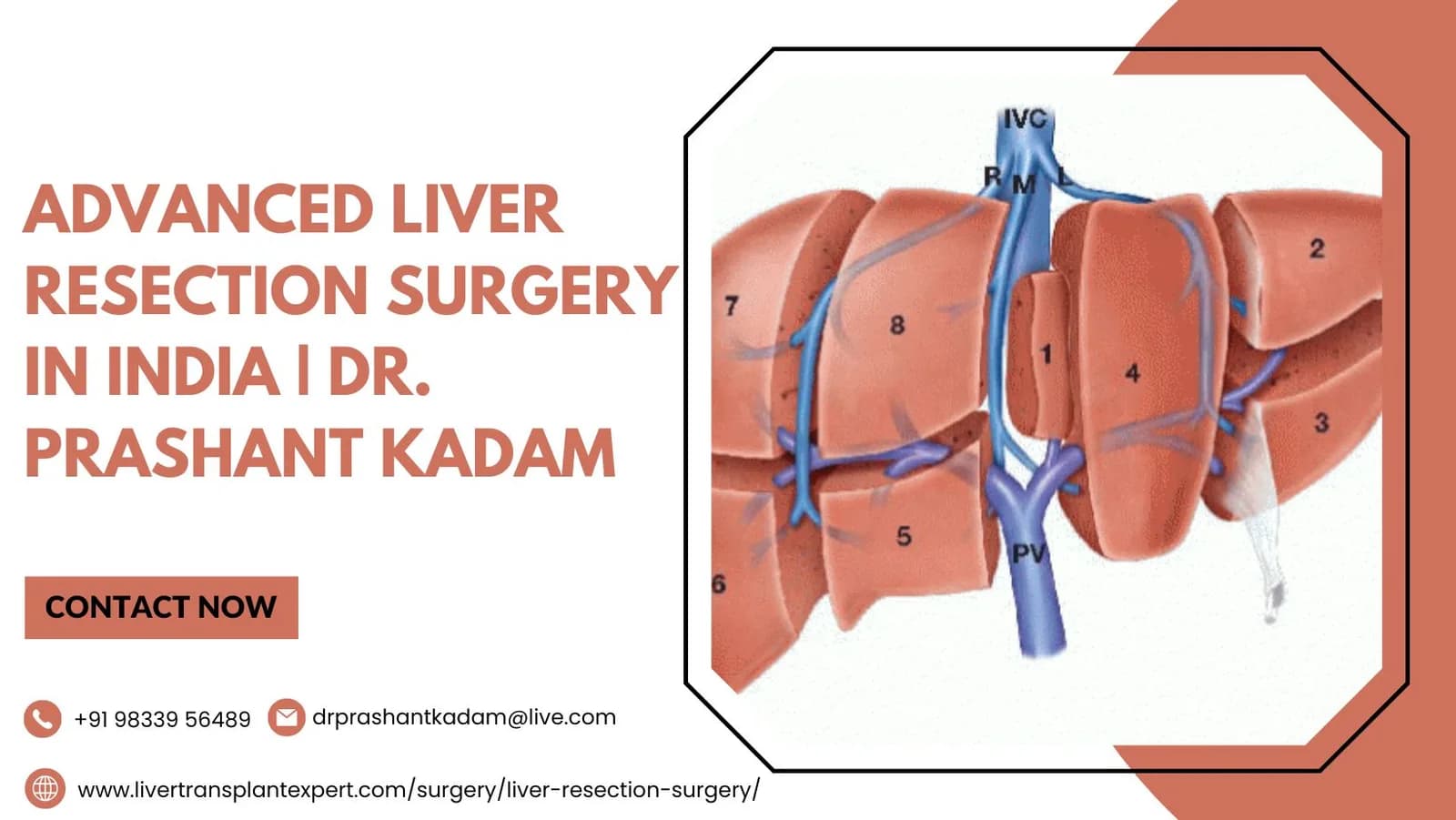 Advanced Liver Resection Surgery in India | Dr. Prashant Kadam