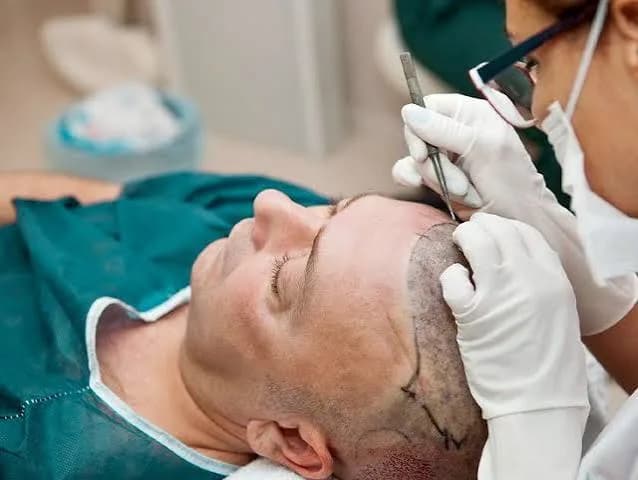 Affordable Hair Transplant in Dehradun — Quality You Can Trust